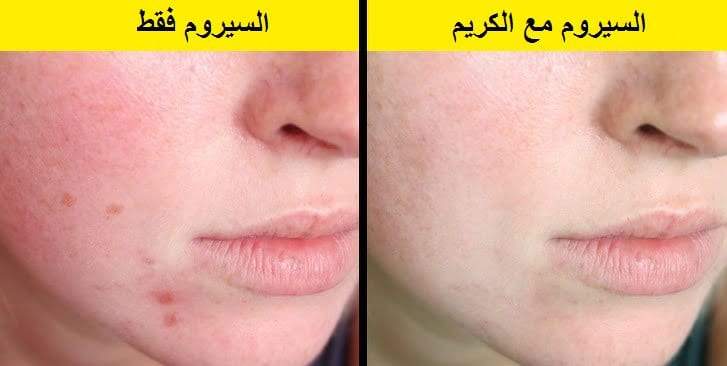 تطبيق منتجات التجميل مثل السيروم مع الكريم مفيد للبشرة