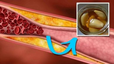 علاج الدهون الثلاثية