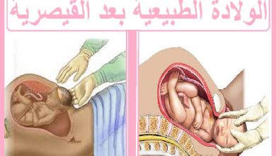 الولادة الطبيعية بعد القيصرية