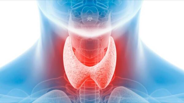 هل يمكن علاج قصور الغدة الدرقية نهائيًا