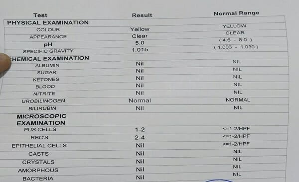 معنى epithelial cells في تحليل البول